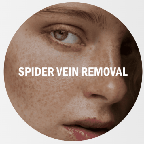 spider-imd